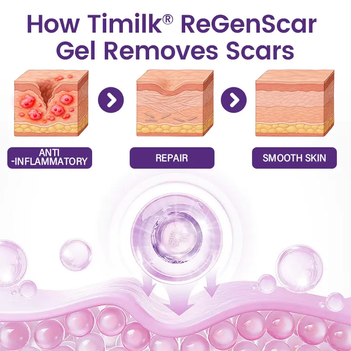 Timilk® SkinRenew Smoothing Gel