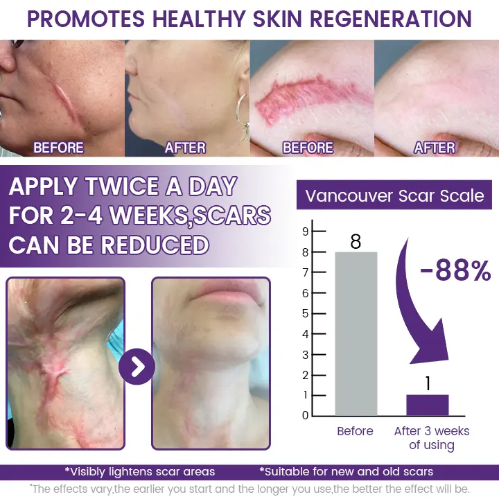 Timilk® SkinRenew Smoothing Gel