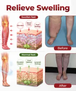 Timilk® SwellVeil Leg Circulation Cream