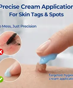 Timilk® 7-Day Skin Tag & Spot Eraser Cream