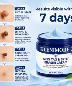 Timilk® 7-Day Skin Tag & Spot Eraser Cream