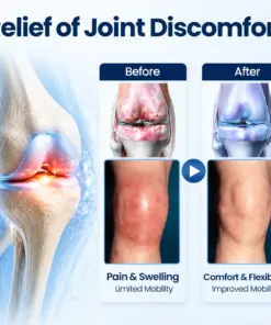 Timilk® ArthriNAD+ Pro Advanced Joint Recovery Cream