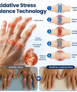 Timilk® ArthriNAD+ Pro Advanced Joint Recovery Cream