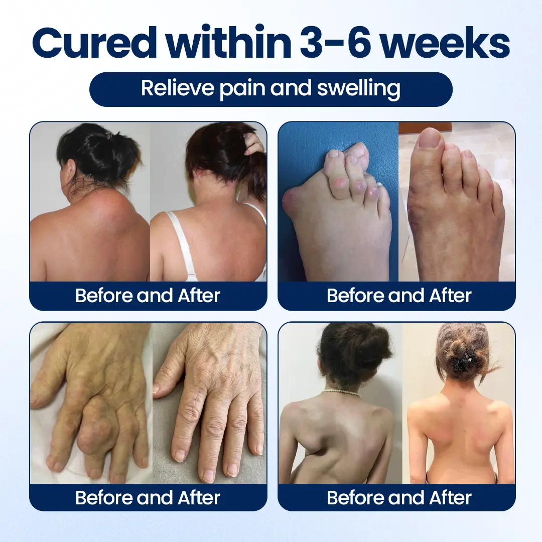 Timilk® ArthriNAD+ Pro Advanced Joint Recovery Cream