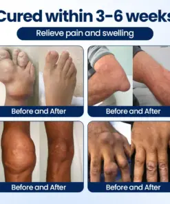 Timilk® ArthriNAD+ Pro Advanced Joint Recovery Cream