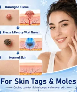 Timilk® CryoClear Pro Bump Renewal Spray