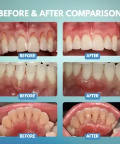 Timilk® GumRescue Precision Gel
