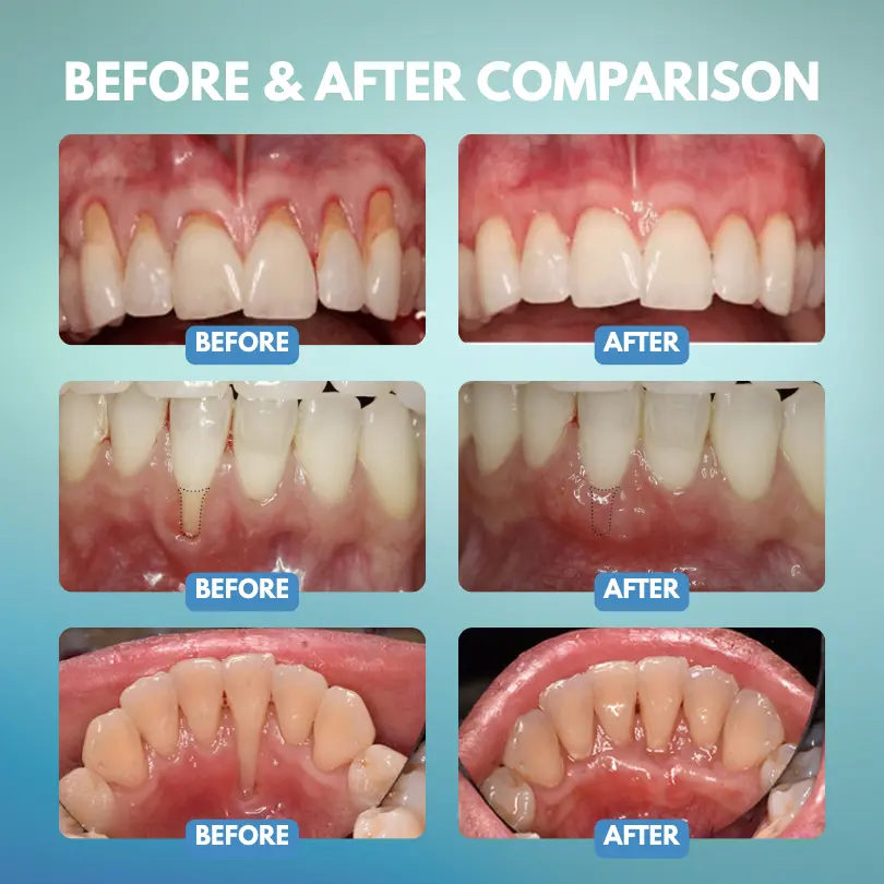 Timilk® GumRescue Precision Gel