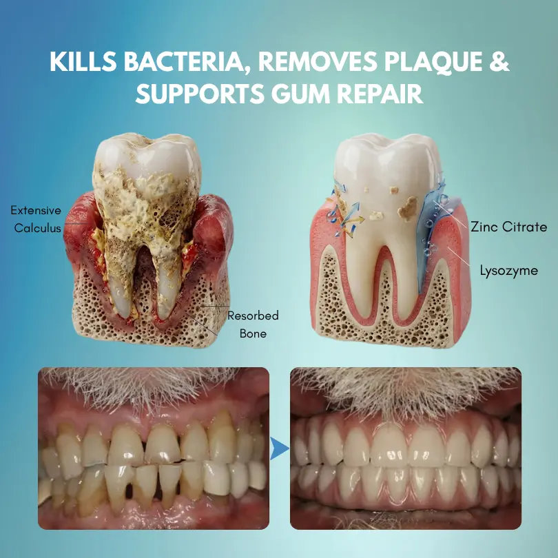 Timilk® GumRescue Precision Gel