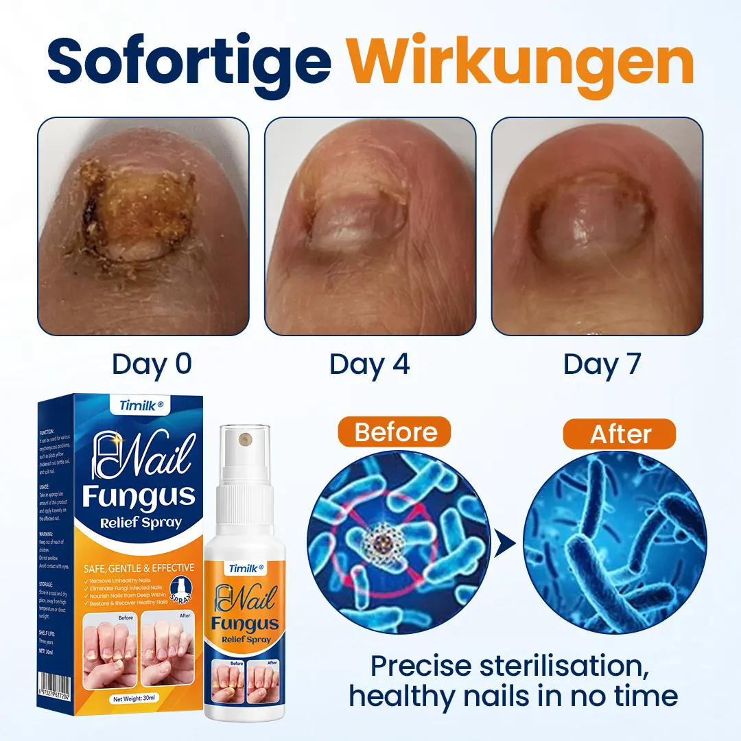 Timilk® Nail Fungus Relief Spray
