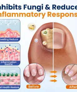 Timilk® Nail Fungus Relief Spray