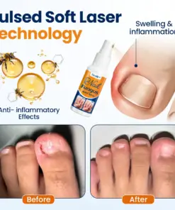 Timilk® Nail Fungus Relief Spray