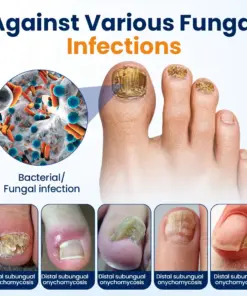 Timilk® Nail Fungus Relief Spray