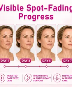 Timilk®LumiVera Advanced Dark Spot Correcting Cream