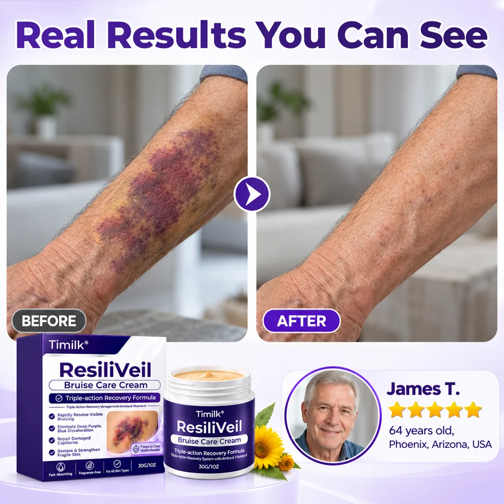 Timilk® ResiliVeil Bruise Care Cream - Image 2