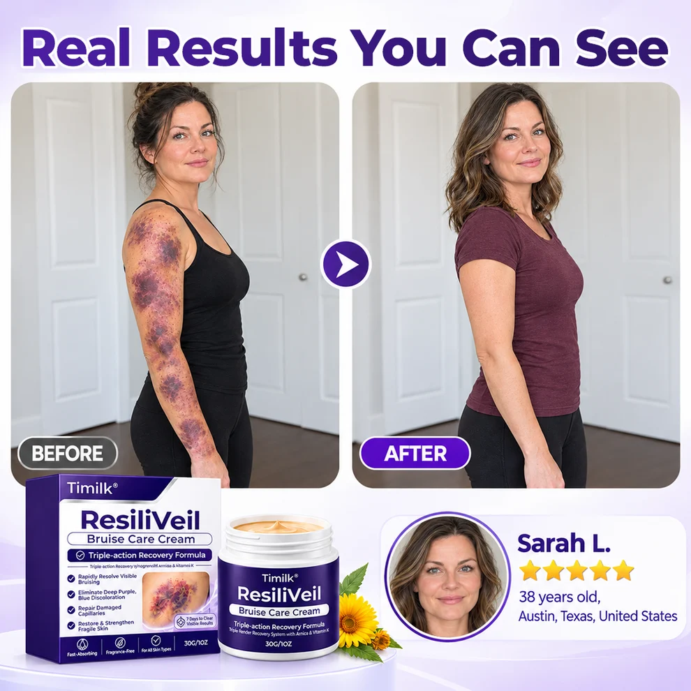 Timilk® ResiliVeil Bruise Care Cream - Image 3