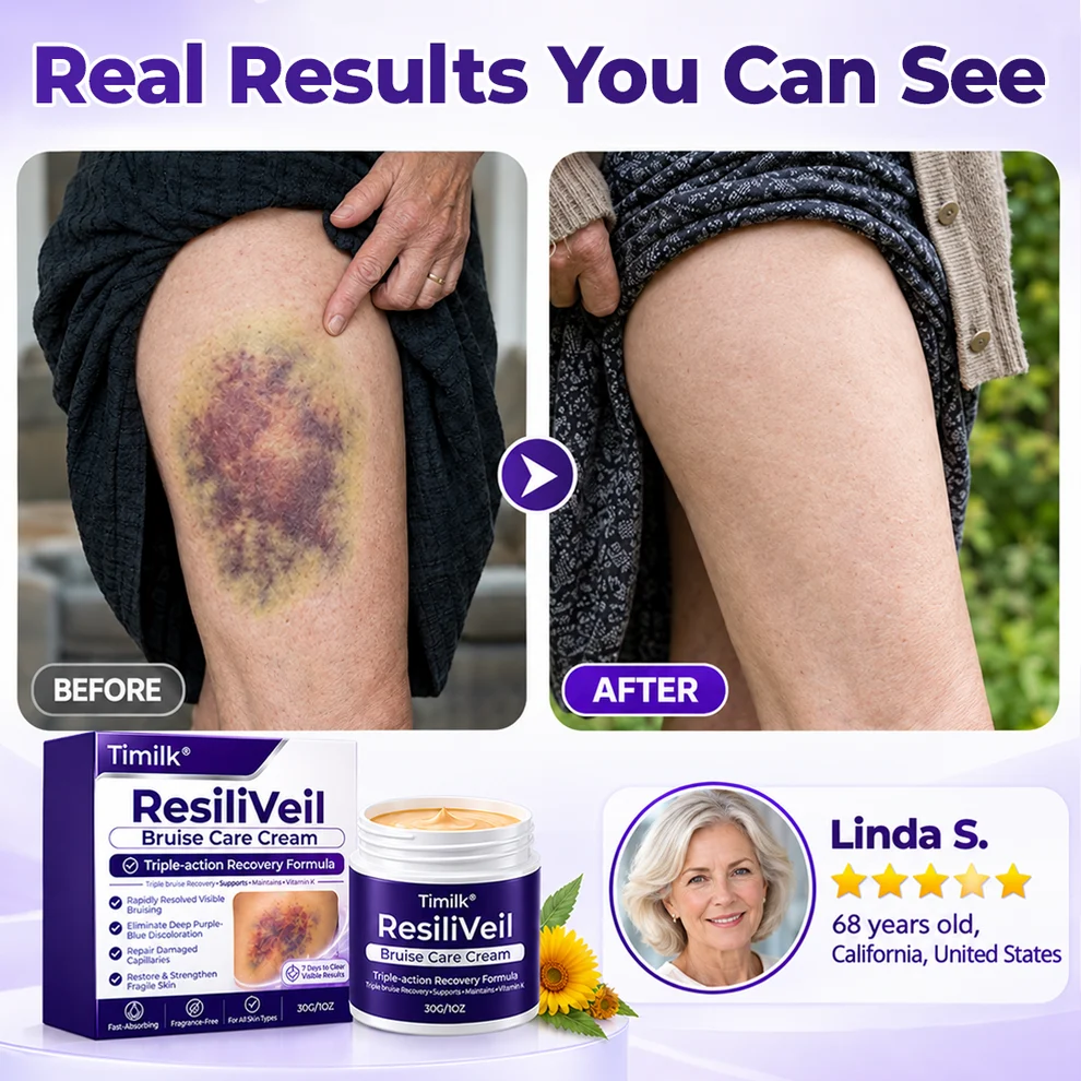 Timilk® ResiliVeil Bruise Care Cream - Image 4