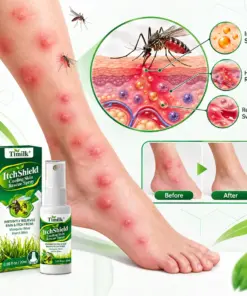 Timilk® ItchShield Cooling Skin Rescue Spray