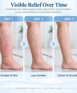 Timilk® LightLeg Expert Microcirculation Cream