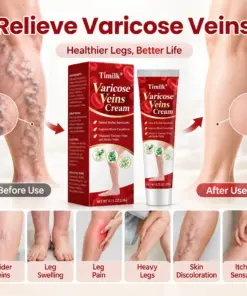 Timilk® Varicose Veins Cream