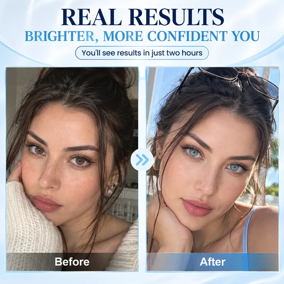 Timilk® IrisShift Advanced Eye Color Drops - Image 2