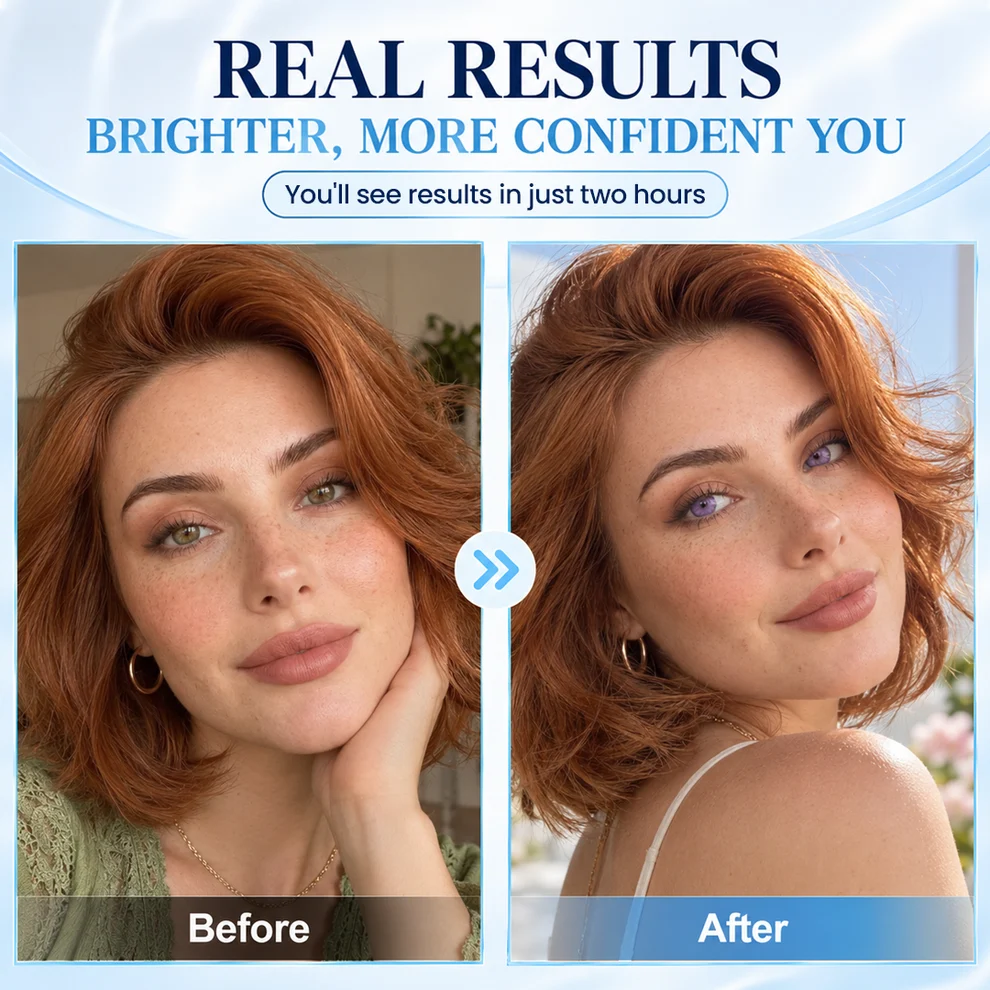 Timilk® IrisShift Advanced Eye Color Drops - Image 4