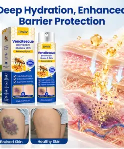 Timilk® VenoRescue Bee Venom Bruise & Skin Recovery Spray