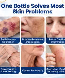 Timilk® VenoRescue Bee Venom Bruise & Skin Recovery Spray